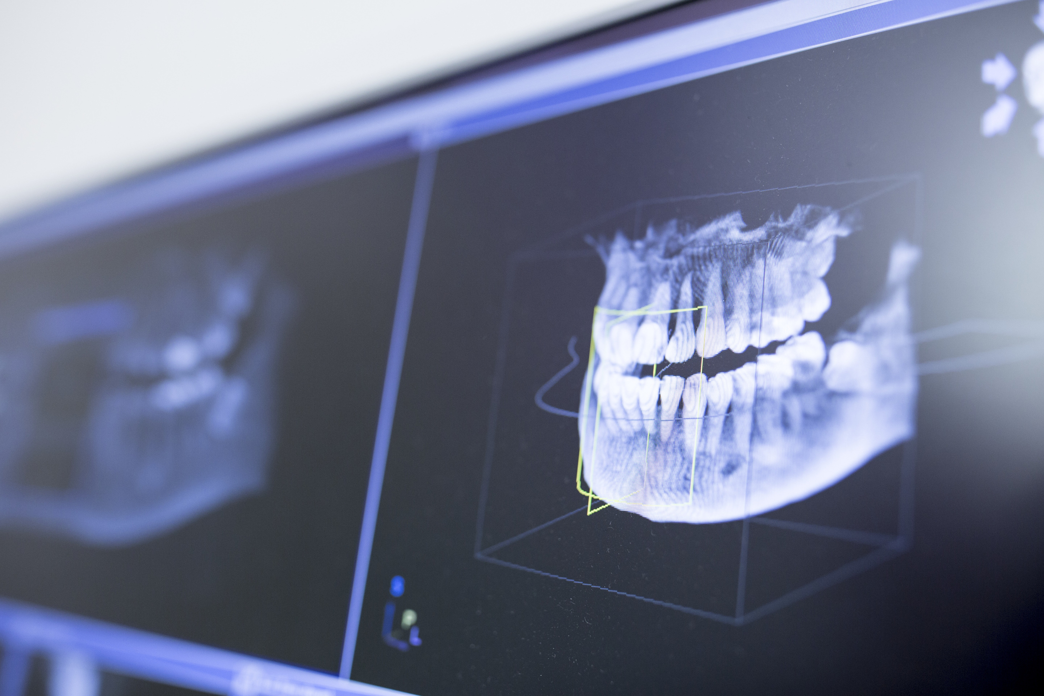 Close-up of teeth x-ray in dentist clinic.